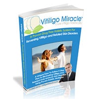 Vitiligo Miracle PDF