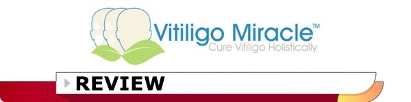 Vitiligo Miracle Review